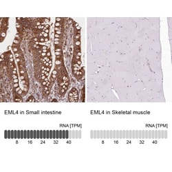 EML4 Antibody, Novus Biologicals 25 &mu;L, Unlabeled:Antibodies, Polyclonal